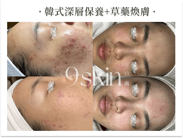 韓式深層保養＋草藥煥膚