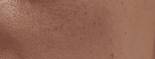 保養品一直買,皮膚卻沒變好